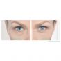 Remescar Eye Bags & Dark Circles Αποτελεσματική Κρέμα Ματιών για τις Σακούλες & τους Μαύρους Κύκλους, 8ml